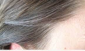 يؤخر ظهور الشيب 