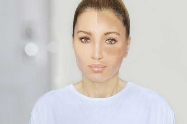 تجربتي مع منقوع زيت اكليل الجبل للبشرة