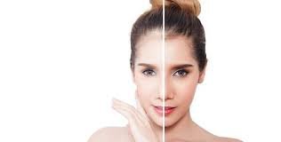 تجربتي مع حبوب الجلوتاثيون